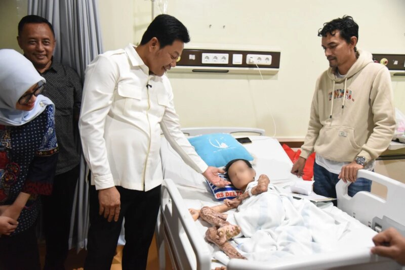 Bupati Subandi Pastikan M. Izzan Korban Luka Bakar 46 Persen Dapat Perawatan Maksimal di RSUD Notopuro – Detiktoday.com