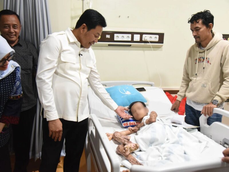 Bupati Subandi Pastikan M. Izzan Korban Luka Bakar 46 Persen Dapat Perawatan Maksimal di RSUD Notopuro – Detiktoday.com